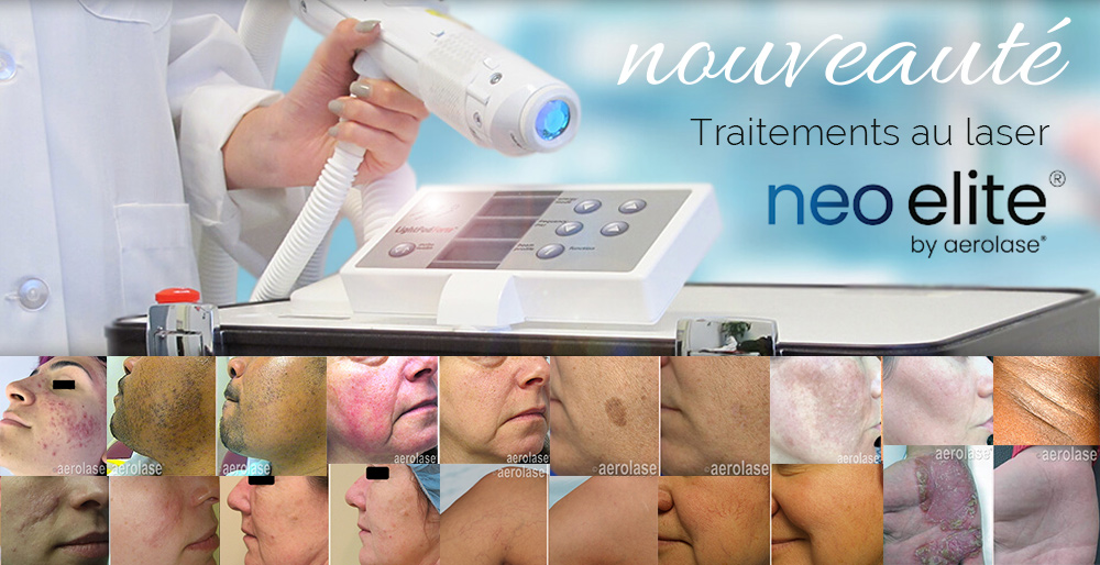 ban-accueil-aerolase