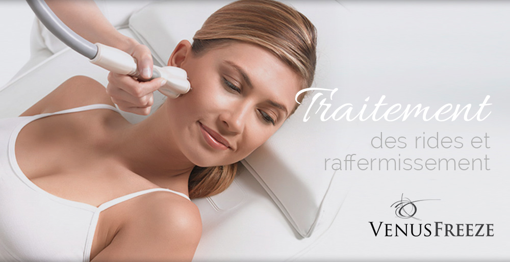 ban-accueil-venus-freeze-1