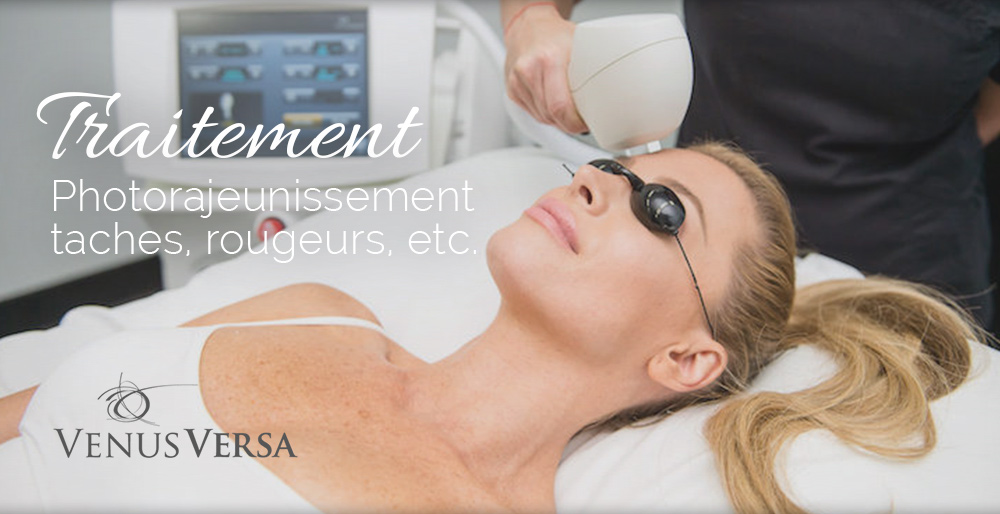 ban-accueil-venus-versa