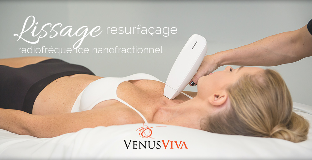 ban-accueil-venus-viva